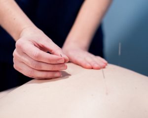 acupuncture for skin health Sandpoint
