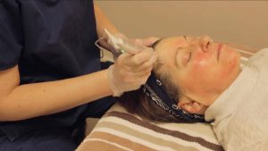Skin Health Sandpoint Idaho